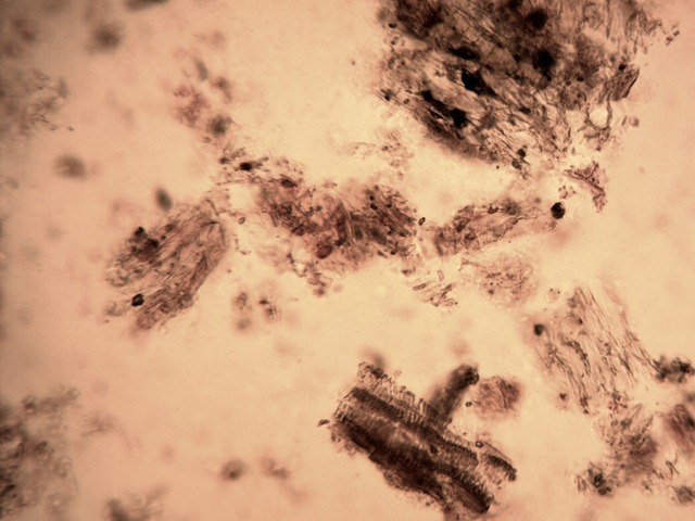 rheum1