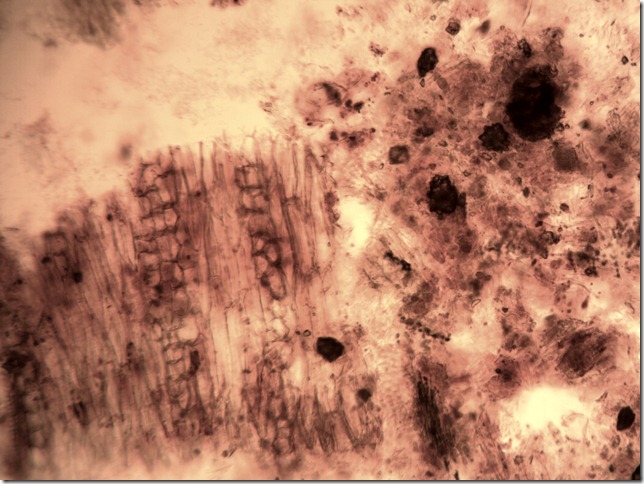 rheum2