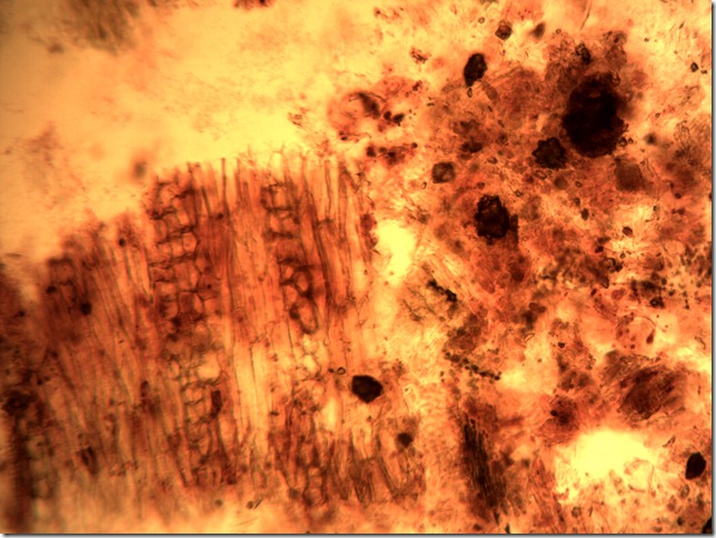 rheum4